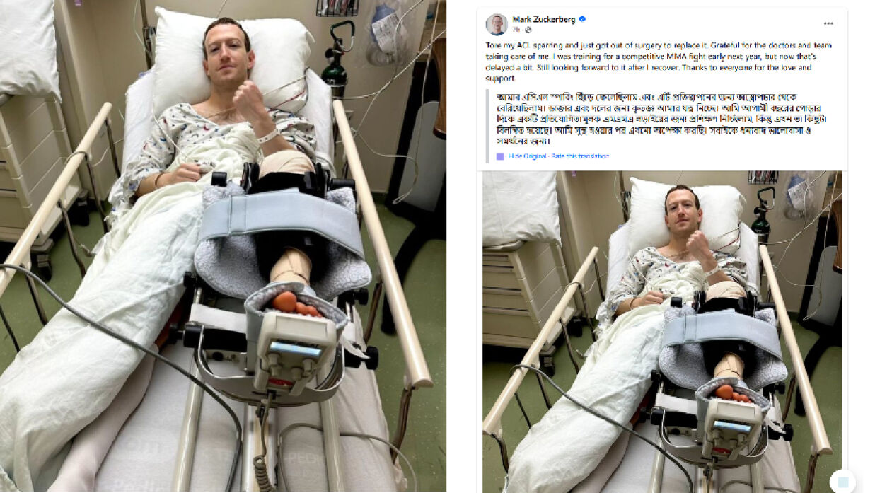 মার্ক জুকারবার্গের লিগামেন্টে ইনজুরি, করতে হয়েছে অস্ত্রোপচার