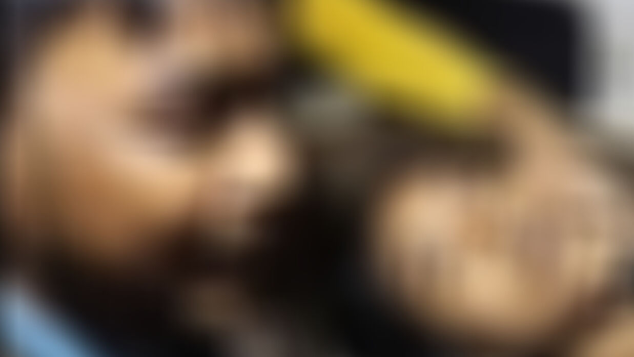 বাবাকে না পেয়ে প্রতিপক্ষের হামলা, গুরুতর আহত স্কুলছাত্রী