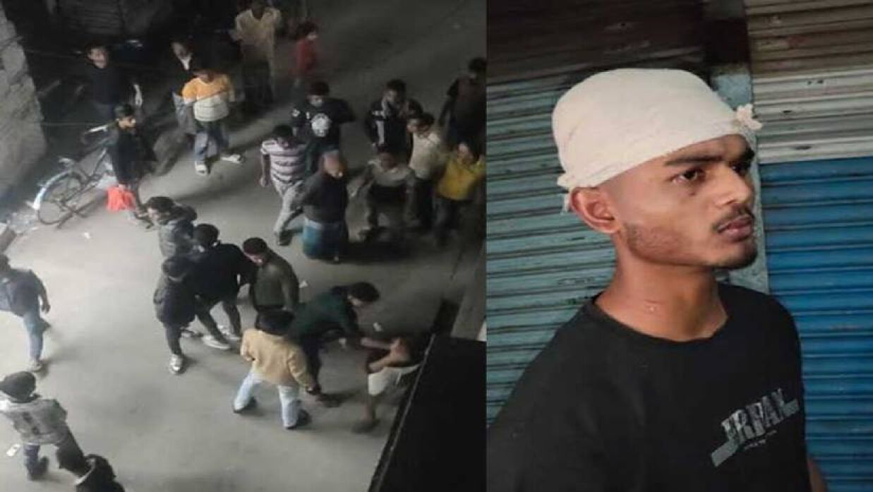 বন্ধুর প্রেমিকাকে ‘কিউট’ বলায় মাথা ফাটালো শুভর