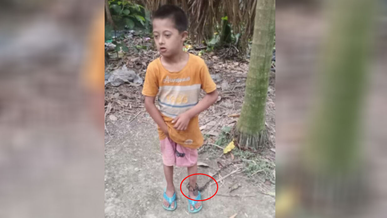 প্রতিবন্ধী শিশুকে শিকল দিয়ে গাছে বেঁধে নির্যাতন