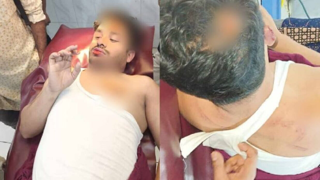 সাব্বির আহমেদের উপর  ছাত্রলীগের  হামলা