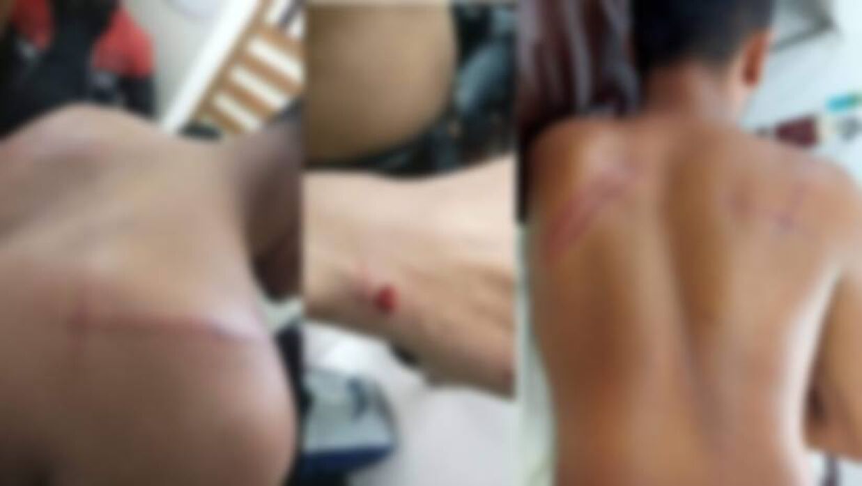 মারধরে আহত ছাত্রদল নেতাকর্মী
