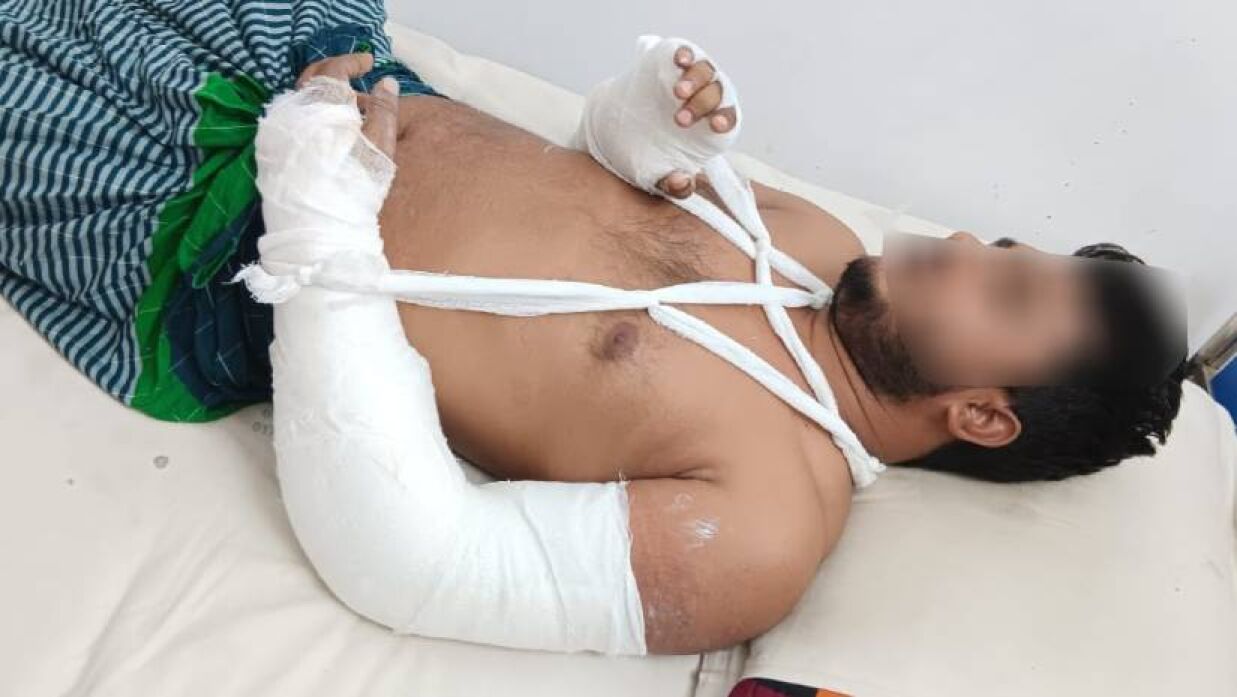 আহত শিক্ষক মো. হাসান