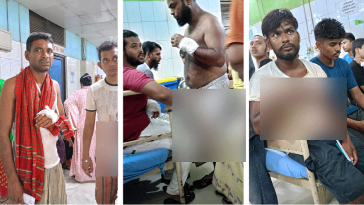 কোরবানি দিতে গিয়ে আহত