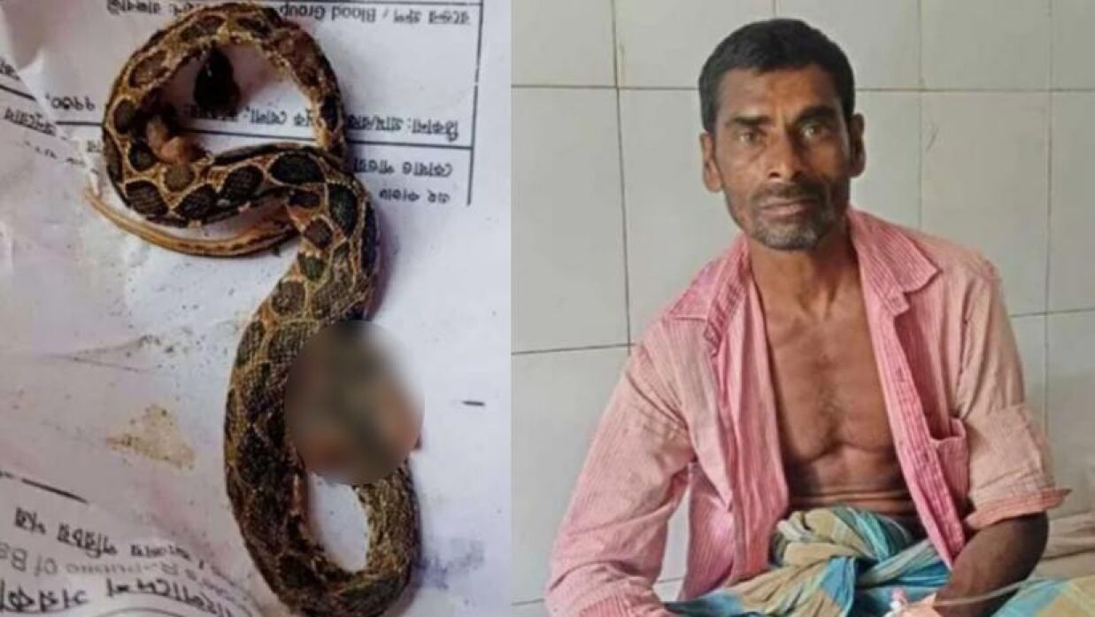ছোবল খেয়ে রাসেলস ভাইপার নিয়েই হাসপাতালে আরেক কৃষক
