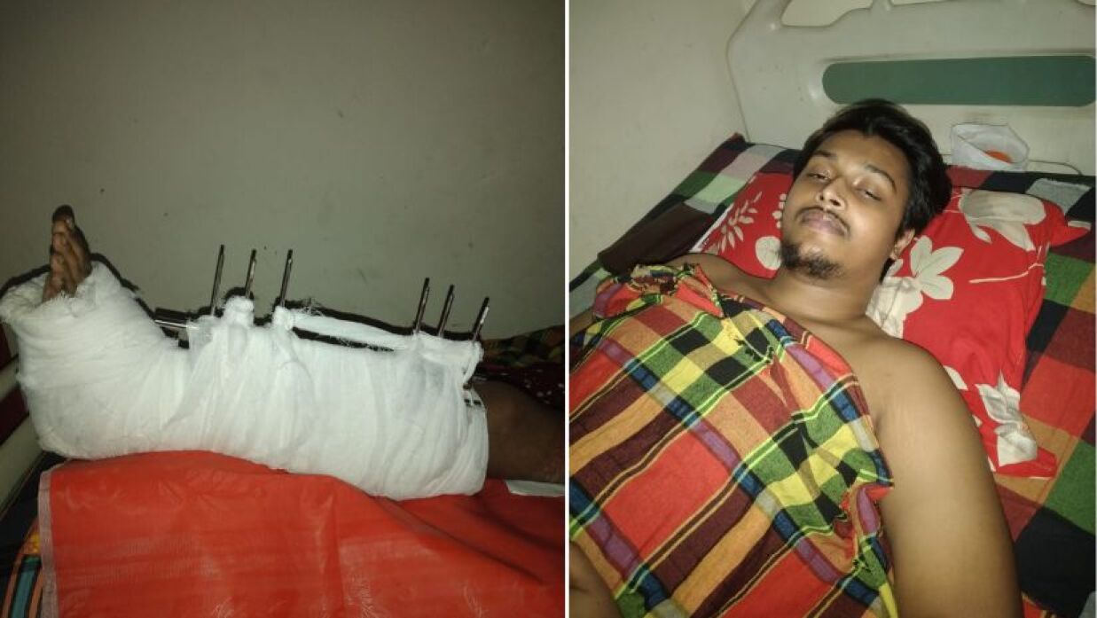 বৈষম্যবিরোধী ছাত্র আন্দোলনে আহত হওয়া ঢাকা কলেজের শিক্ষার্থী আব্দুল্লাহ আল ইমরান