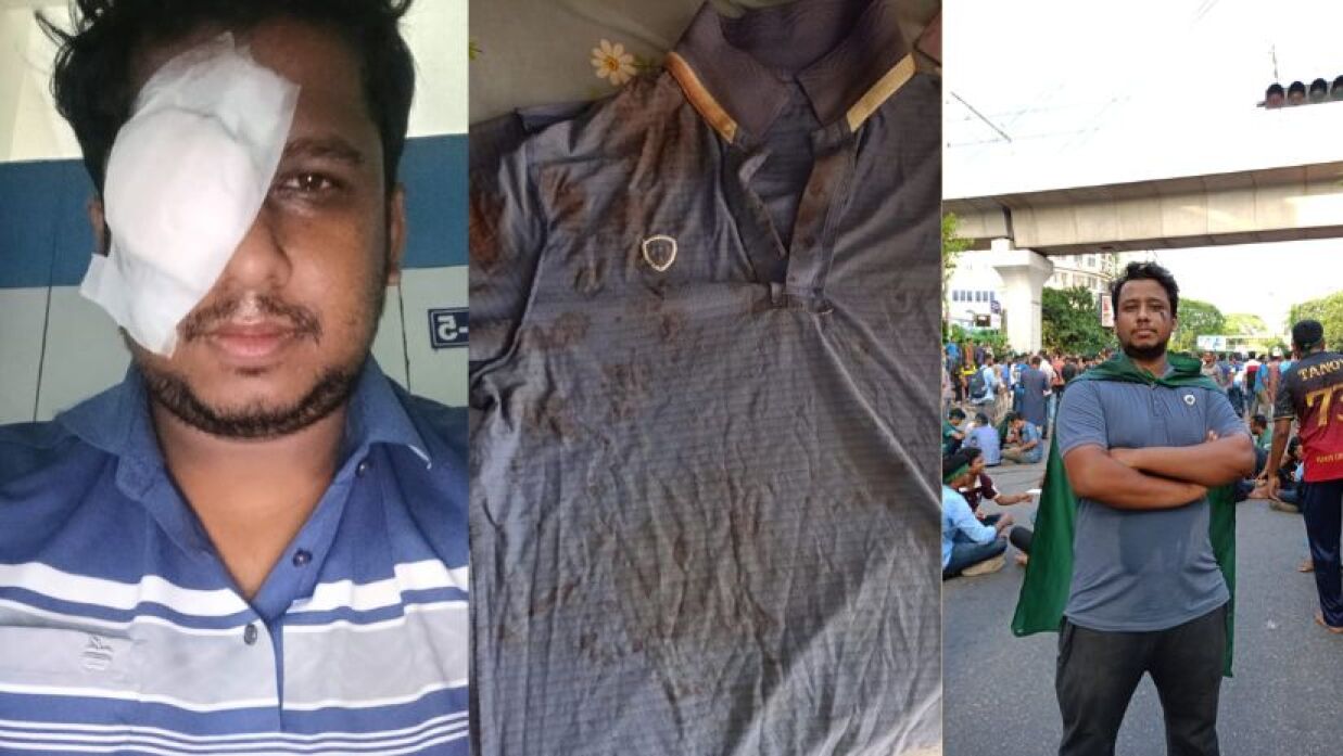 বাম থেকে চোখে আহত হওয়ার পরের ছবি মাঝখানে পুলিশের গুলিতে রক্তাক্ত টি শার্ট ও শাহবাগ আন্দোলনরত অবস্থায়
