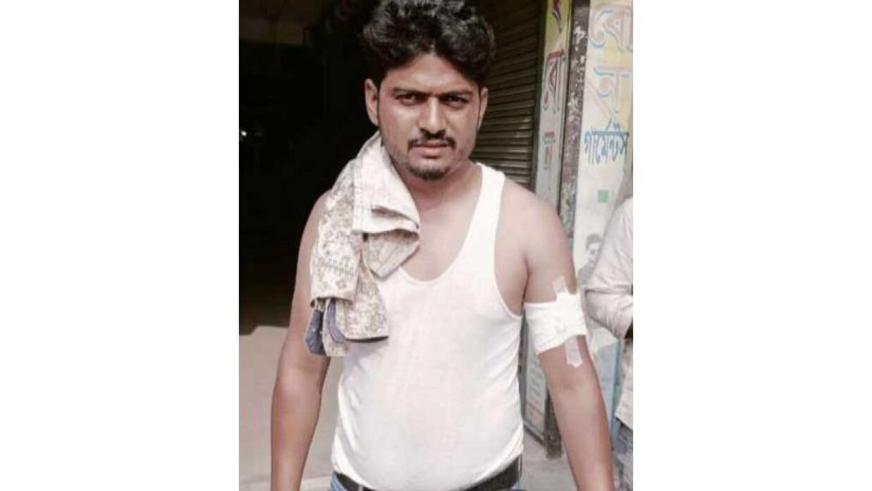 নাটোরের বড়াইগ্রামে বিএনপির দুই পক্ষের সংঘর্ষে গুলিবিদ্ধ রুবেল