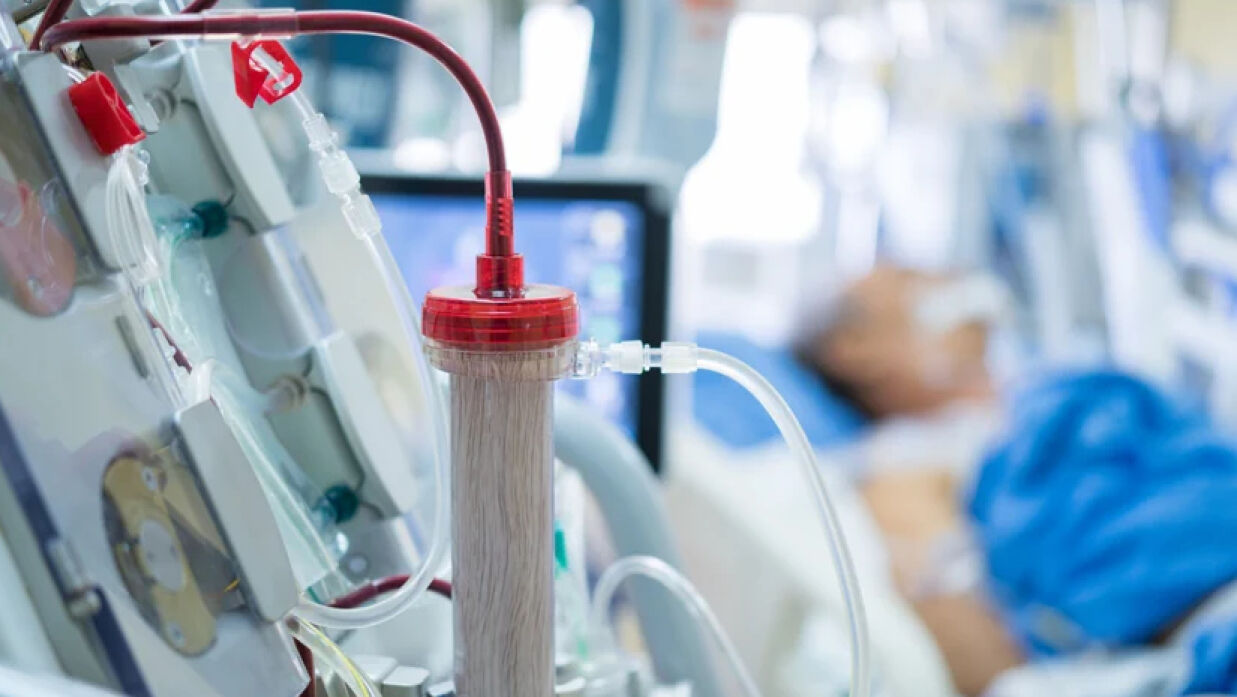 ডায়ালাইসিস করাতে ৯৩% রোগী আর্থিক সংকটে পড়েন