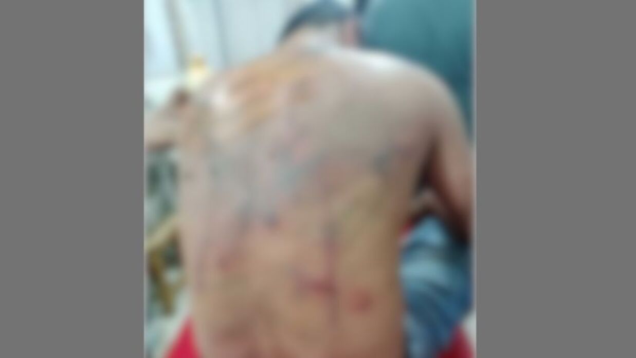 শিক্ষককে মারধর করে হাসপাতালে পাঠানোর অভিযোগ