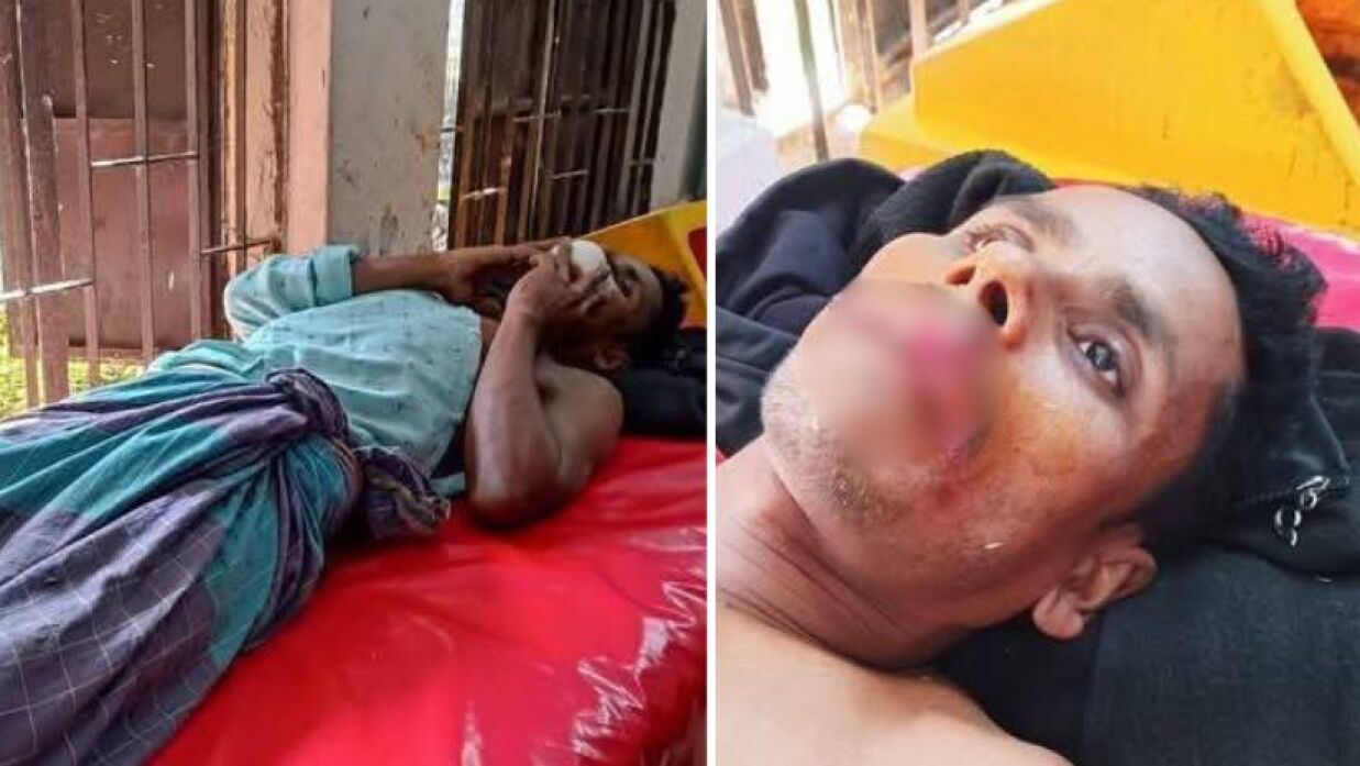 শিয়ালের কামড়ে আহত ২