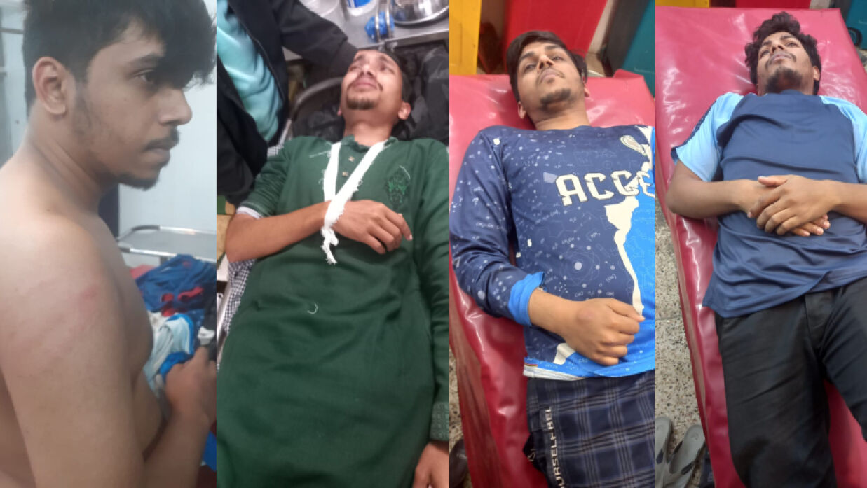 আহত চার শিক্ষার্থী 