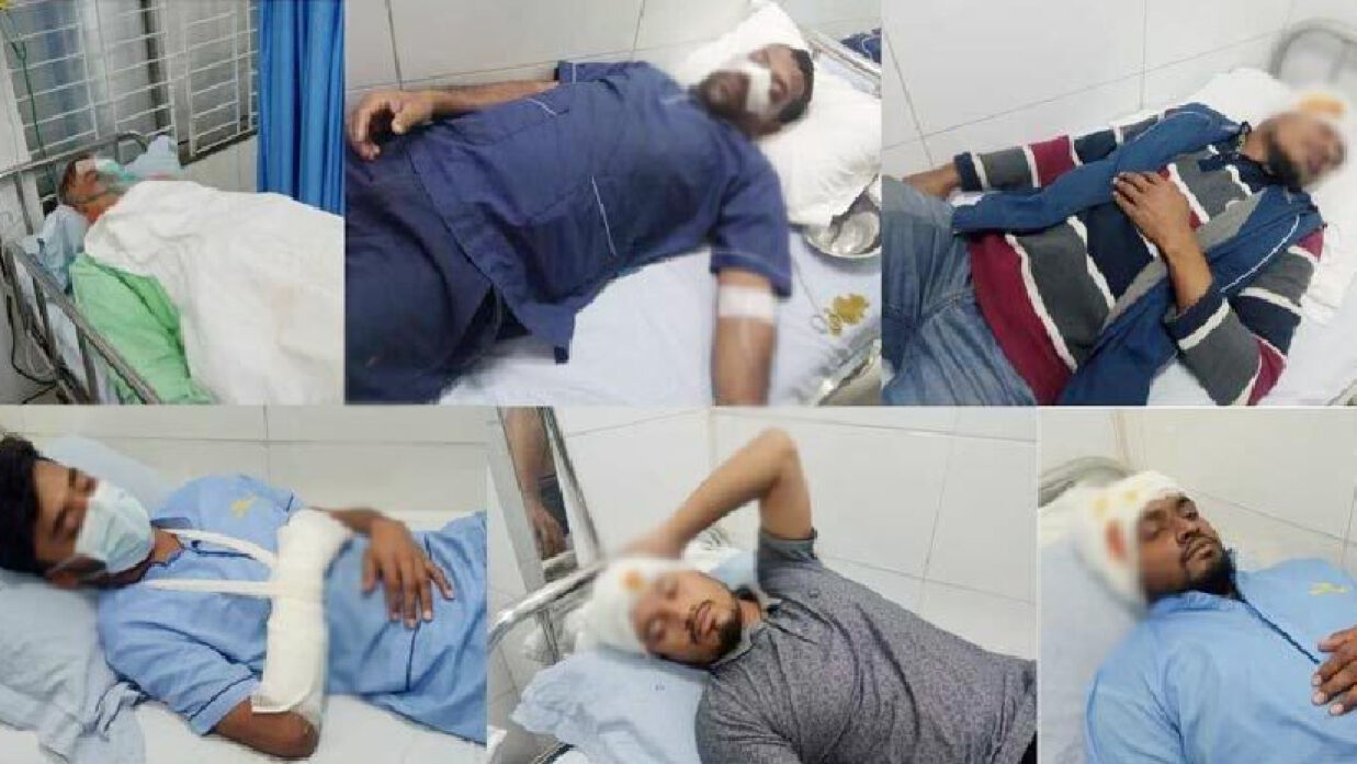 আহতদের কয়েকজন