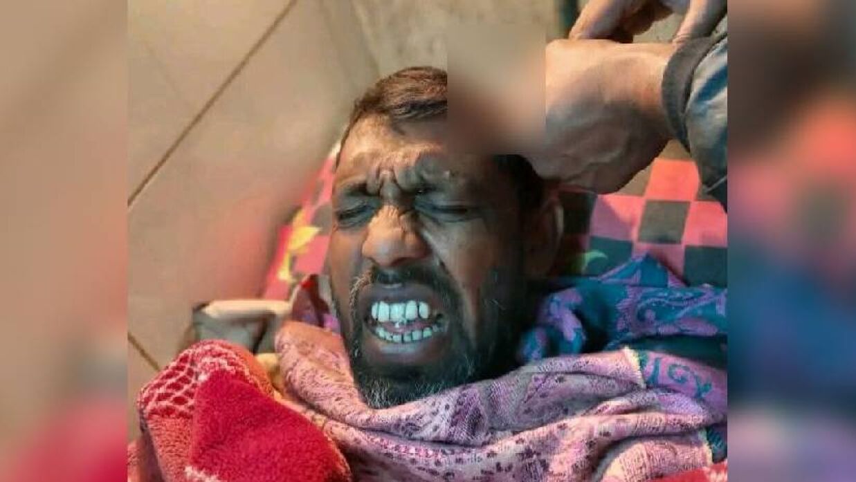 সংঘর্ষে আহত