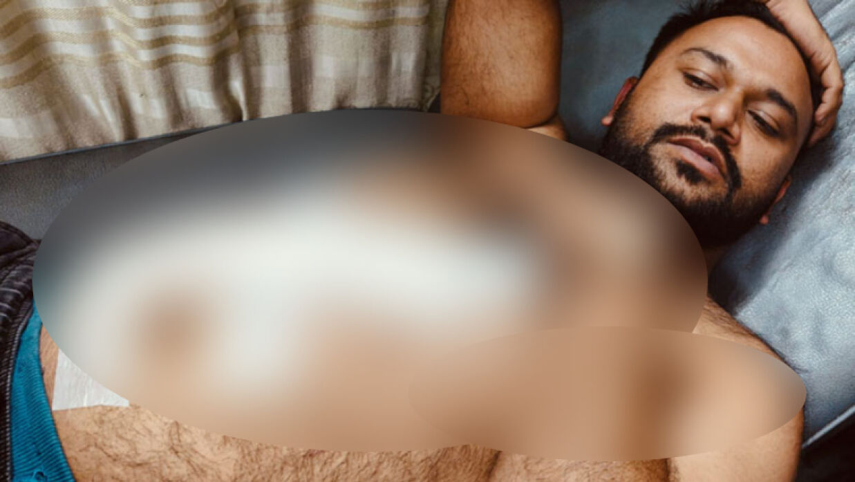 সংঘর্ষে আহত একজন