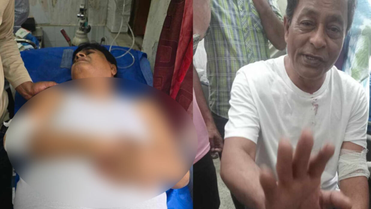 সংঘর্ষের ঘটনায় আহত দুজন