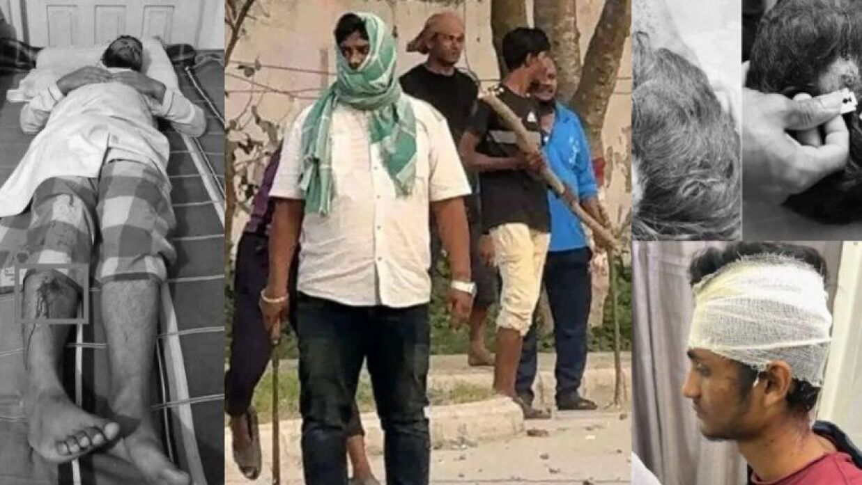 ক্যাম্পাসে ক্যাম্পাসে ঘটনা সাম্প্রতিক ঘটনা