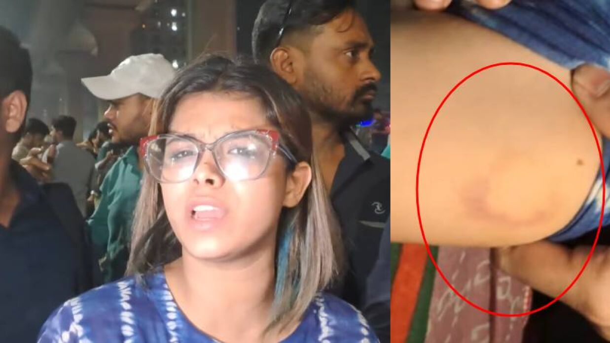 বাঁয়ে মাহিরা ইভা, ডানে কামড়ের দাগ