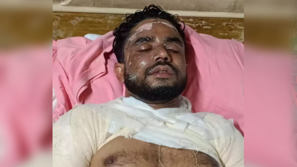 দগ্ধ মো. নূর নবী