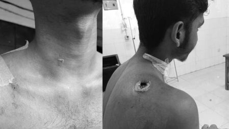 তা’মীরুল মিল্লাতের হাসিবের স্বপ্ন ছিল ডাক্তার হওয়ার, এখন ভর্তি হতে চান বেসরকারি বিশ্ববিদ্যালয়ে