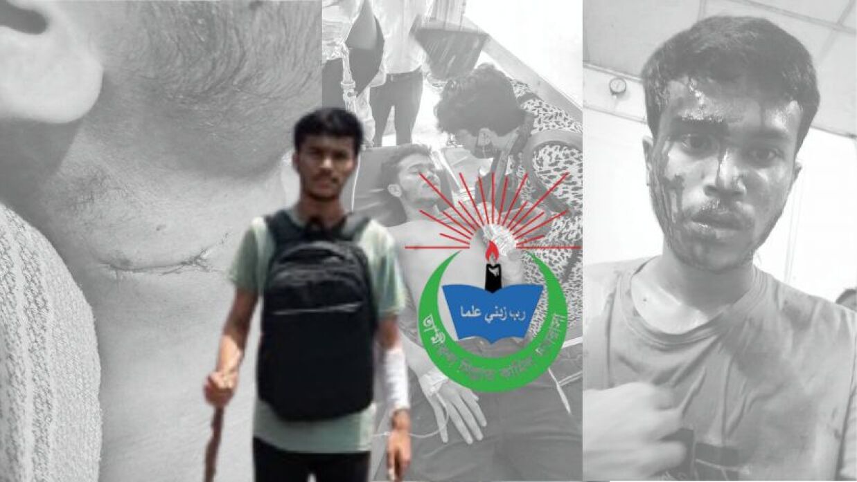 জুলাই আন্দোলনে আহত জুবাইয়ের