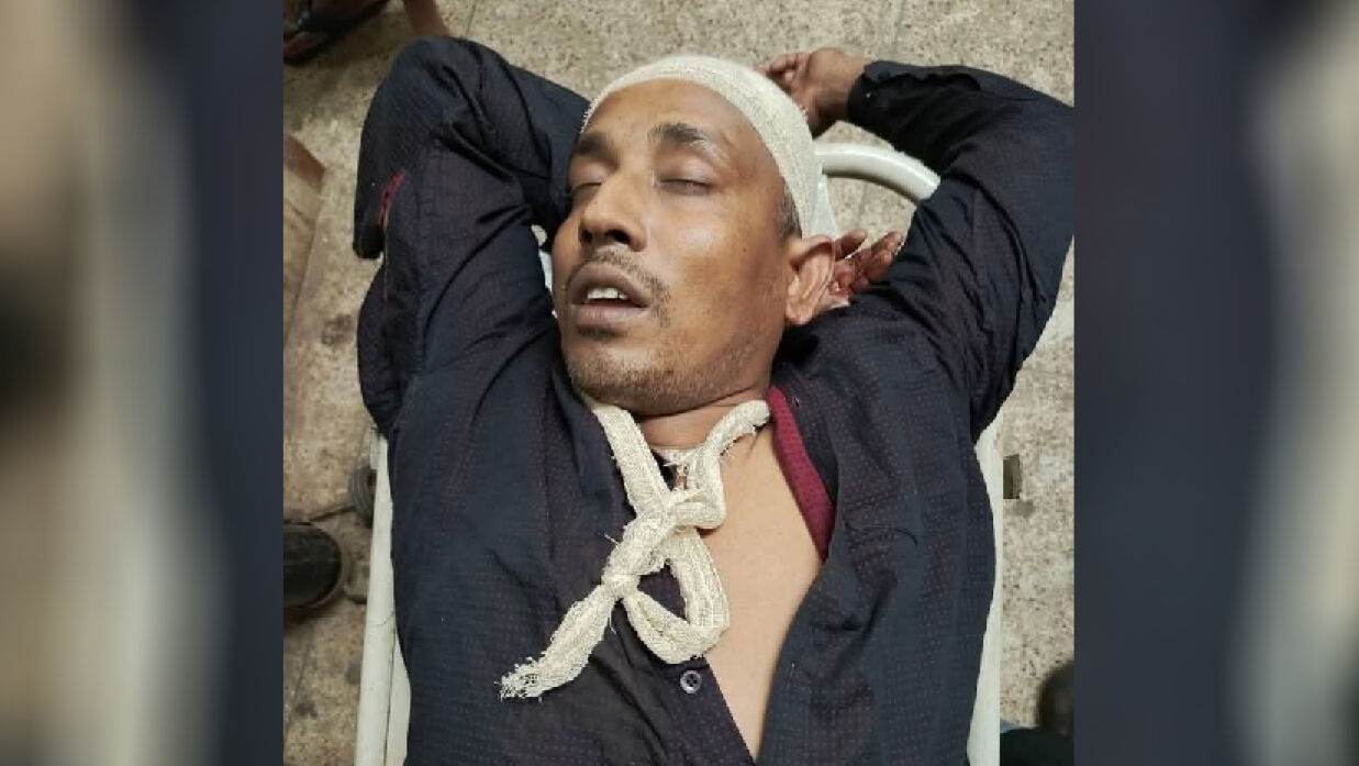 মাদকাসক্ত ব্যক্তিকে ধরতে গিয়ে মারধরের শিকার এএসআই