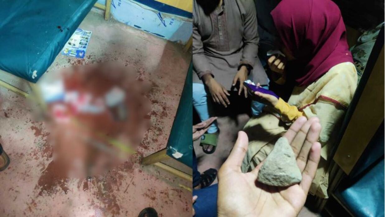 পাথরের আঘাতে জখম চবি ছাত্রী সোনিয়া আক্তার