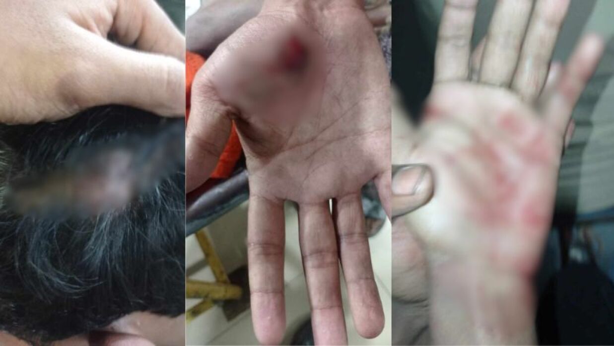 ছুরিকাঘাতে আহত ঢাকা কলেজের শিক্ষার্থী