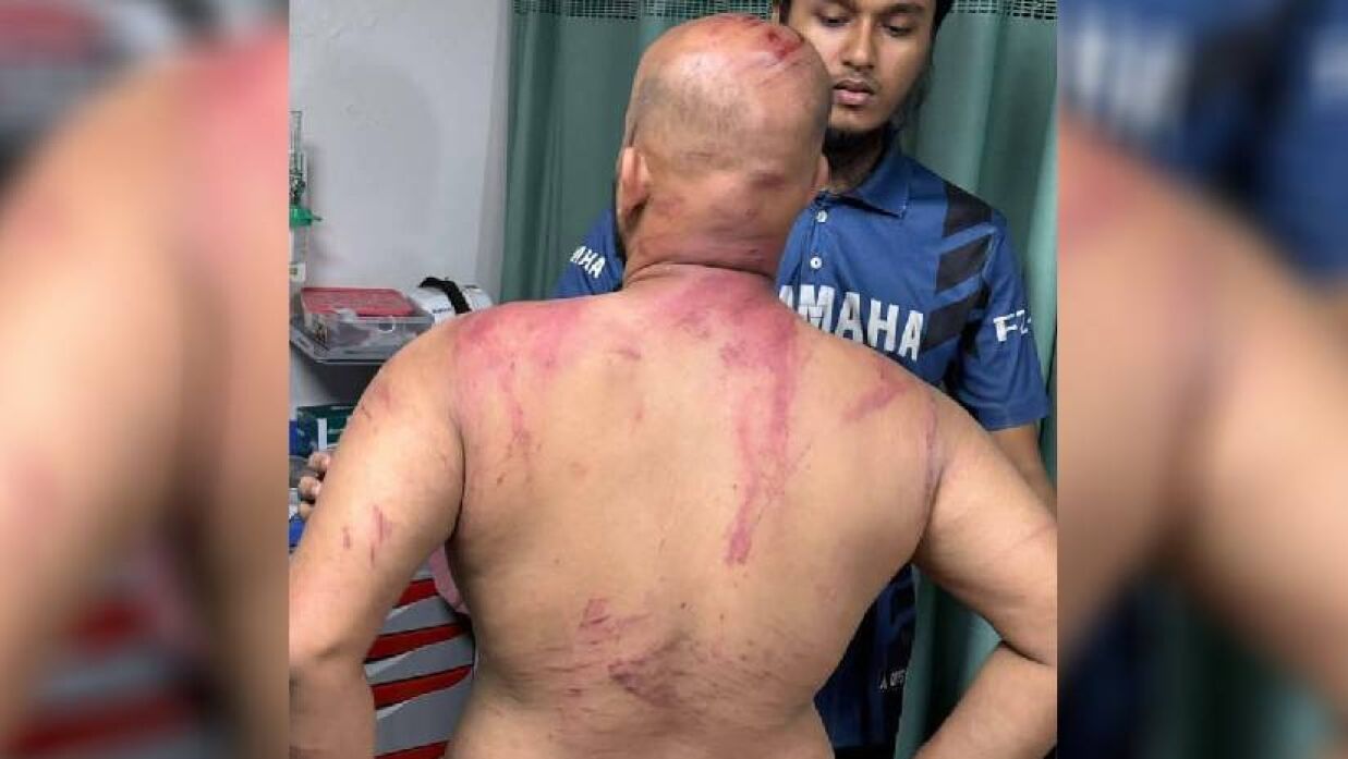 হামলার শিকার