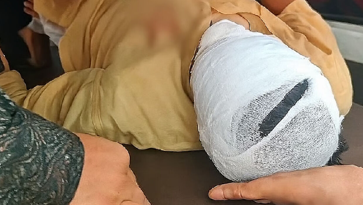 গুরুতর আহত উল্লাপাড়ায় উপজেলা বিএনপির সাবেক সদস্যসচিব আজাদ হোসেন