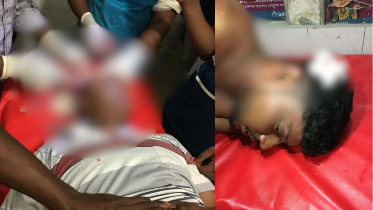 নাটোরের লালপুরে ডাকাত দলের কোপে আহত দু’জন
