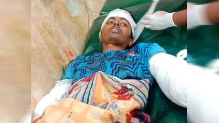 স্ত্রীর গোপন ভিডিও করায় ছোট ভাইয়ের দুই হাতের কব্জি কর্তন