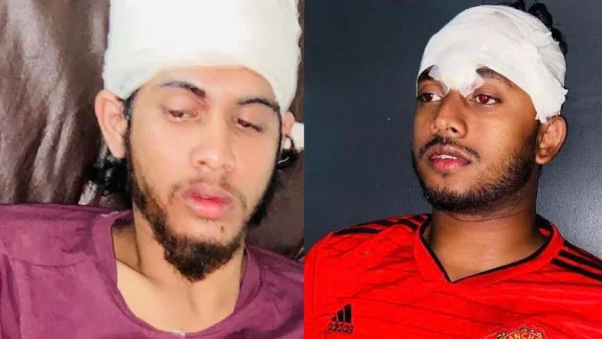 আহত বৈষম্যবিরোধী ছাত্র আন্দোলনের দুই কর্মী