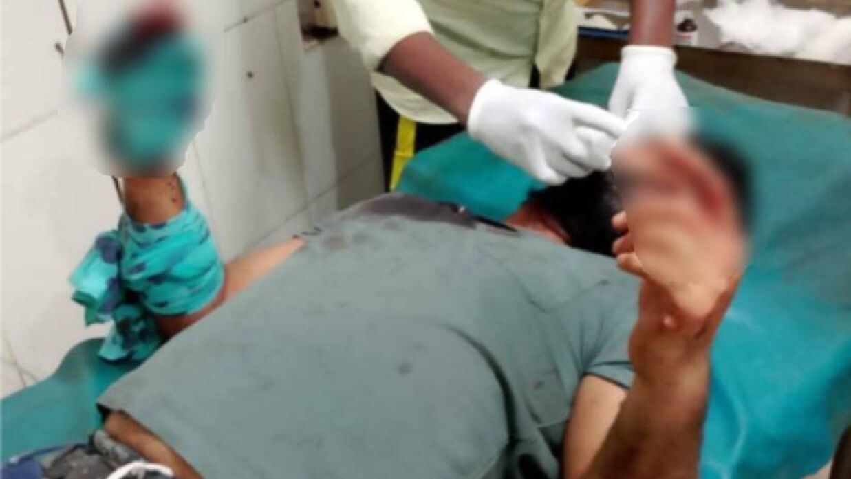 আহত হাসান আলী