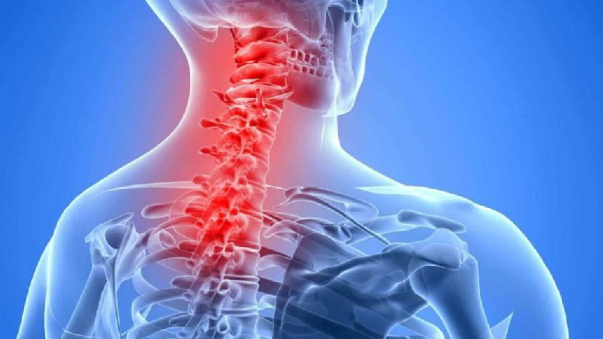 ঘাড়ব্যথা