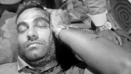 নোয়াখালীতে ছাত্রদল নেতার ওপর হামলা—মারধর