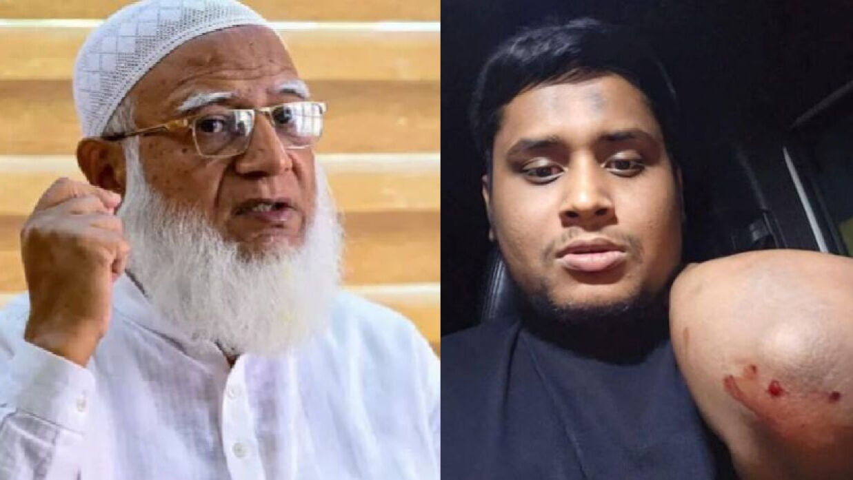 জামায়াত আমির ও আহত হাসনাত